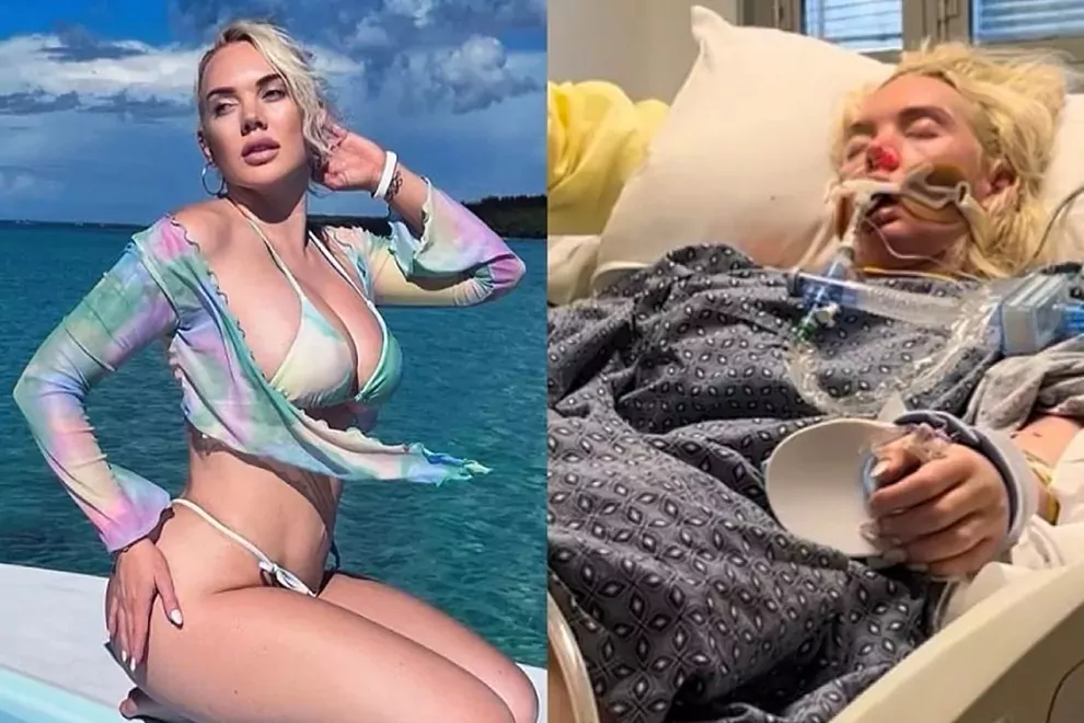 La modelo Jennifer Barlow sufre la amputación de una pierna por culpa de una bacteria “carnívora”
