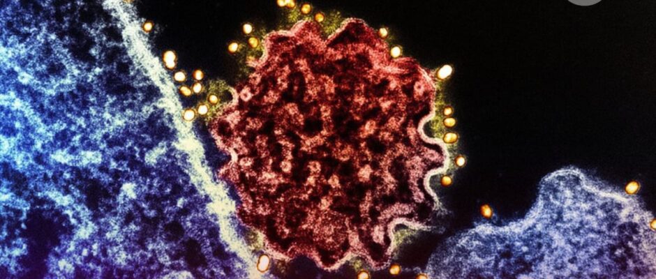 ¿Existe vacuna contra el virus Nipah? OMS da detalles