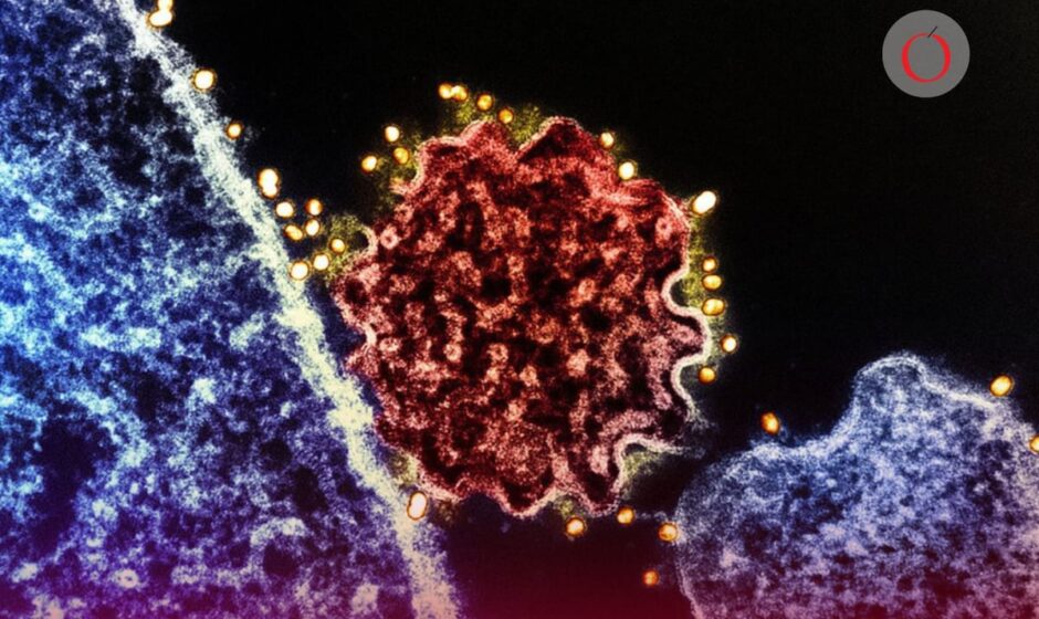 ¿Existe vacuna contra el virus Nipah? OMS da detalles